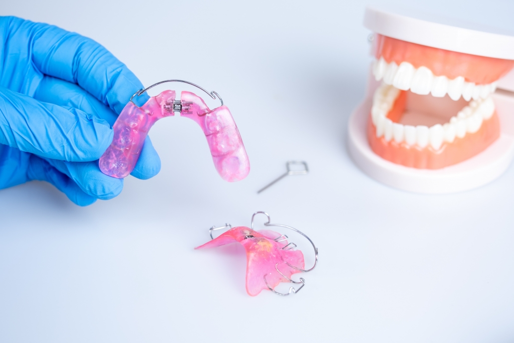 Step-by-Step Guide to Orthodontic Appliances